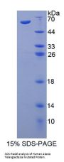 Human Ataxia Telangiectasia Mutated (ATM) Protein