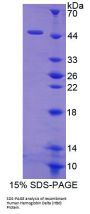 Human Hemoglobin Delta (HBd) Protein