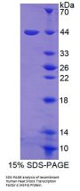 Human Heat Shock Transcription Factor 4 (HSF4) Protein