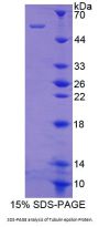Human Tubulin Epsilon (TUBe) Protein