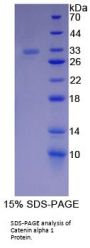 Human Catenin Alpha 1 (CTNNa1) Protein