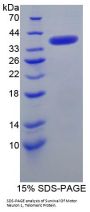 Human Survival Of Motor Neuron 1, Telomeric (SMN1) Protein