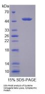Human Cysteine Conjugate Beta Lyase, Cytoplasmic (CCbL1) Protein