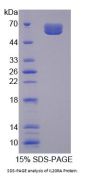 Human Interleukin 20 Receptor Alpha (IL20Ra) Protein