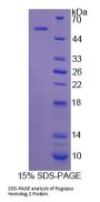 Human Pygopus Homolog 2 (PYGO2) Protein