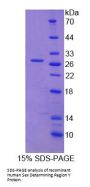 Human Sex Determining Region Y (SRY) Protein