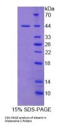 Human Absent In Melanoma 2 (AIM2) Protein