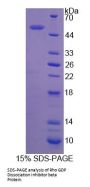 Human Rho GDP Dissociation Inhibitor Beta (ARHGDIb) Protein