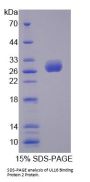 Human UL16 Binding Protein 2 (ULBP2) Protein