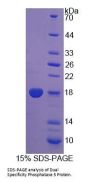 Human Dual Specificity Phosphatase 5 (DUSP5) Protein