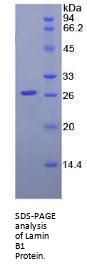 Human Lamin B1 (LMNB1) Protein