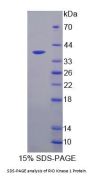 Human RIO Kinase 1 (RIOK1) Protein