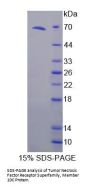Human Tumor Necrosis Factor Receptor Superfamily Member 10C (TNFRSF10C) Protein