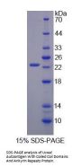 Human Uveal Autoantigen With Coiled Coil Domains And Ankyrin Repeats (UACA) Protein