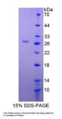 Human DnaJ/HSP40 Homolog Subfamily C, Member 12 (DNAJC12) Protein