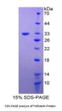 Human Follistatin (FS) Protein