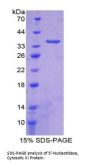 Human 5'-Nucleotidase, Cytosolic III (NT5C3) Protein