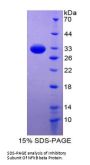 Human Inhibitory Subunit Of NF Kappa B Beta (IkBb) Protein