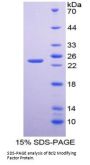 Human Bcl-2-Modifying Factor (BMF) Protein