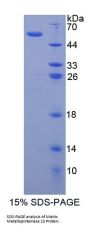 Human Matrix Metalloproteinase 15 (MMP15) Protein
