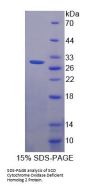 Human SCO Cytochrome Oxidase Deficient Homolog 2 (SCO2) Protein