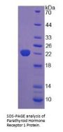 Human Parathyroid Hormone Receptor 1 (PTHR1) Protein