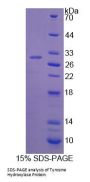 Human Tyrosine Hydroxylase (TH) Protein