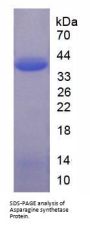 Human Asparagine Synthetase (ASNS) Protein