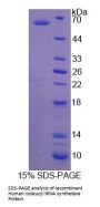 Human Isoleucyl tRNA Synthetase (IARS) Protein