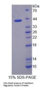 Human Interferon Regulatory Factor 5 (IRF5) Protein