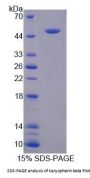 Human Importin Subunit Beta-1 (KPNB1) Protein