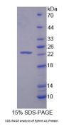 Human Ephrin A1 (EFNA1) Protein