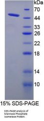 Human Mannose Phosphate Isomerase (MPI) Protein