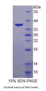 Human Transient Receptor Potential Cation Channel Subfamily A, Member 1 (TRPA1) Protein
