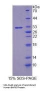 Human BMP Binding Endothelial Regulator (BMPER) Protein