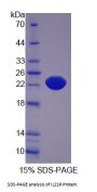 Human Interleukin 21 Receptor (IL21R) Protein