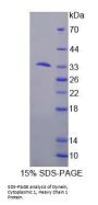 Human Dynein, Cytoplasmic 1, Heavy Chain 1 (DYNC1H1) Protein