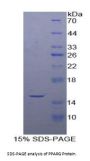 Human Peroxisome Proliferator Activated Receptor Gamma (PPARg) Protein