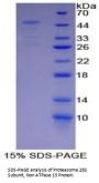 Human 26S Proteasome Non-ATPase Regulatory Subunit 13 (PSMD13) Protein