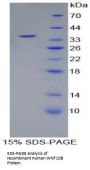 Human Protein Wnt-10b (WNT10B) Protein