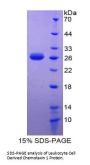 Human Leukocyte Cell Derived Chemotaxin 1 / LECT1 (CNMD) Protein