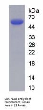 Human Keratin 13 (KRT13) Protein