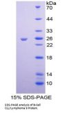 Human B-Cell CLL/Lymphoma 9 (Bcl9) Protein