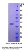 Human Hepatocyte Nuclear Factor 1 Beta (HNF1b) Protein