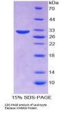 Human Leukocyte Elastase Inhibitor (SERPINB1) Protein