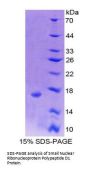 Human Small Nuclear Ribonucleoprotein Polypeptide D1 (SNRPD1) Protein