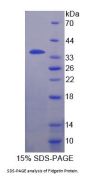 Human Fidgetin (FIGN) Protein