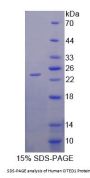 Human Cbp/p300 Interacting Transactivator, With Glu/Asp Rich Carboxy Terminal Domain 1 (CITED1) Protein