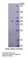 Human Minichromosome Maintenance Deficient 5 (MCM5) Protein