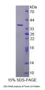 Human Torsin 1A (TOR1A) Protein
